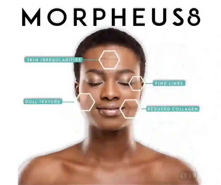 Skin concerns Morpheus8 can treat